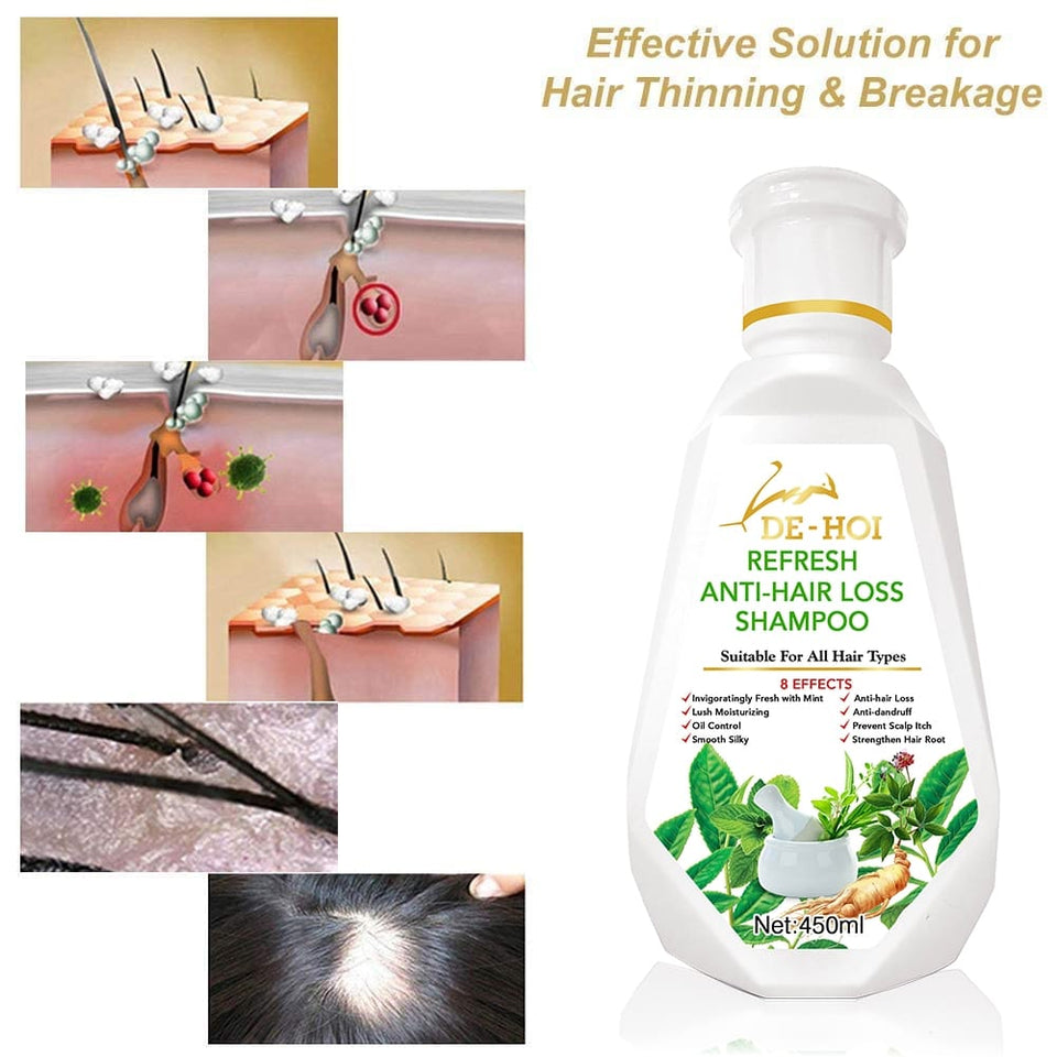 De-hoi Refresh Anti-hair Loss Shampoo Ginger Hair Care Shampoo Helps Stop Hair Loss 450ml