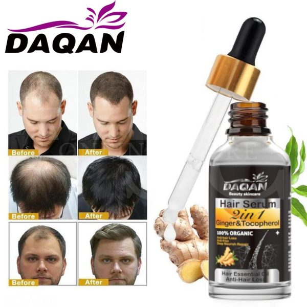 Anti Hair Loss Serum 2 In 1 Natural Hair Fall Serum Ginger And Tocopherol Hair Growth Essence Oil Hair Care Serum | Hair Loss Treatment For Men & Women |