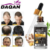 Anti Hair Loss Serum 2 In 1 Natural Hair Fall Serum Ginger And Tocopherol Hair Growth Essence Oil Hair Care Serum | Hair Loss Treatment For Men & Women |
