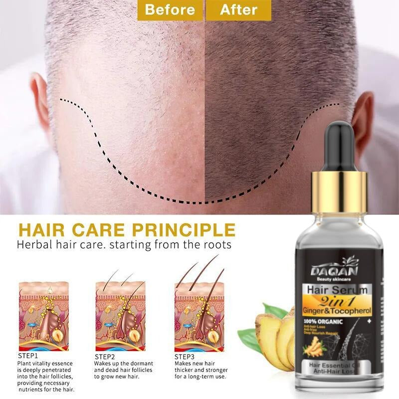 Anti Hair Loss Serum 2 In 1 Natural Hair Fall Serum Ginger And Tocopherol Hair Growth Essence Oil Hair Care Serum | Hair Loss Treatment For Men & Women |