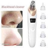 Face Vacuum Suction Blackhead Remover Pore Cleaner