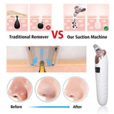 Electric Blackhead Remover, Vacuum Acne Cleaner, Black Spots Removal Device