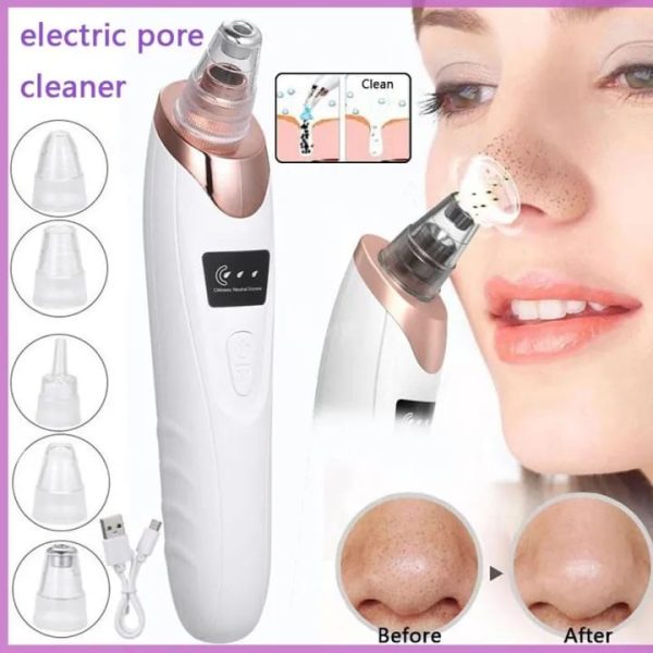 Electric Blackhead Remover, Vacuum Acne Cleaner, Black Spots Removal Device