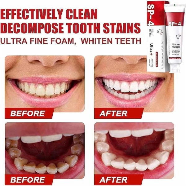 Yayashi Sp-4 Ultra Whitening Toothpaste Probiotic Stain Remover 120gm