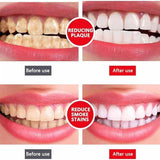 Yayashi Sp-4 Ultra Whitening Toothpaste Probiotic Stain Remover 120gm